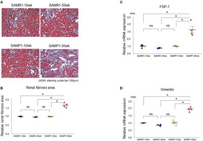 MicroRNA Expression Profiling in Age-Dependent Renal Impairment